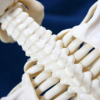 How Long Does A Pinched Nerve Last