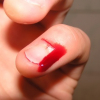 How Long Does Breakthrough Bleeding Last
