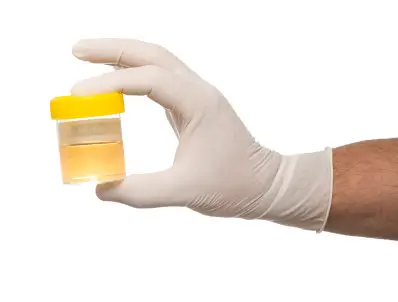 How Long Does Alcohol Stay In Urine