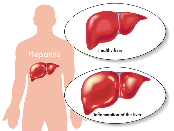 How Long Does A Hepatitis B Vaccine Last